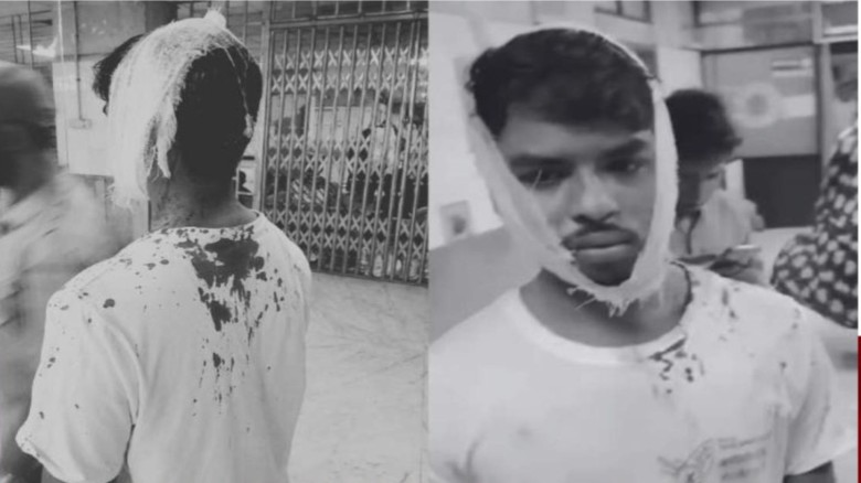ঢাকা পলিটেকনিকে শিবিরের উপর ছাত্রদলের হামলা